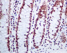 Immunohistochemistry (Formalin/PFA-fixed paraffin-embedded sections) - Anti-CLP1 antibody [EPR7180(2)] - BSA and Azide free (AB248605)