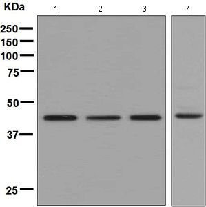 Western blot - Anti-CLP1 antibody [EPR7181] - BSA and Azide free (AB248233), expandable thumbnail