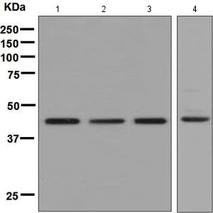 Western blot - Anti-CLP1 antibody [EPR7181] - BSA and Azide free (AB248233)
