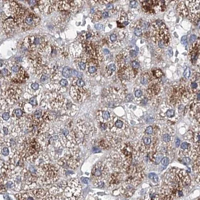 Immunohistochemistry (Formalin/PFA-fixed paraffin-embedded sections) - Anti-CLPB antibody (AB272630)