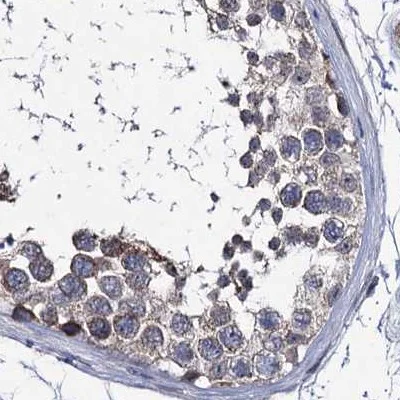 Immunohistochemistry (Formalin/PFA-fixed paraffin-embedded sections) - Anti-CLPB antibody (AB272630)
