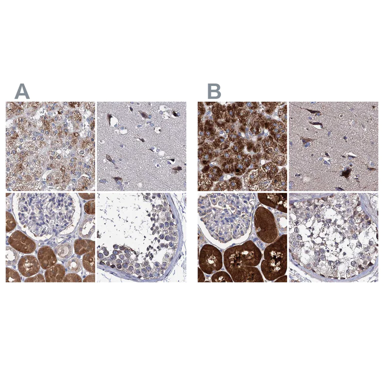 Immunohistochemistry (Formalin/PFA-fixed paraffin-embedded sections) - Anti-CLPB antibody (AB272630)