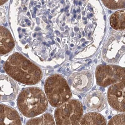 Immunohistochemistry (Formalin/PFA-fixed paraffin-embedded sections) - Anti-CLPB antibody (AB272630)