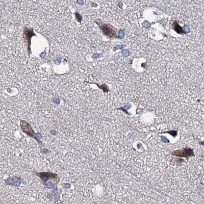 Immunohistochemistry (Formalin/PFA-fixed paraffin-embedded sections) - Anti-CLPB antibody (AB272630)