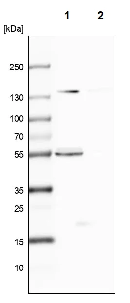 Western blot - Anti-CLPB antibody (AB272630)