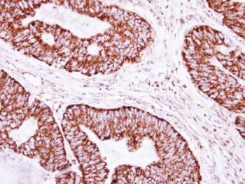 Immunohistochemistry (Formalin/PFA-fixed paraffin-embedded sections) - Anti-CLPP antibody (AB126102)