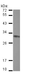 Western blot - Anti-CLPP antibody (AB126102), expandable thumbnail