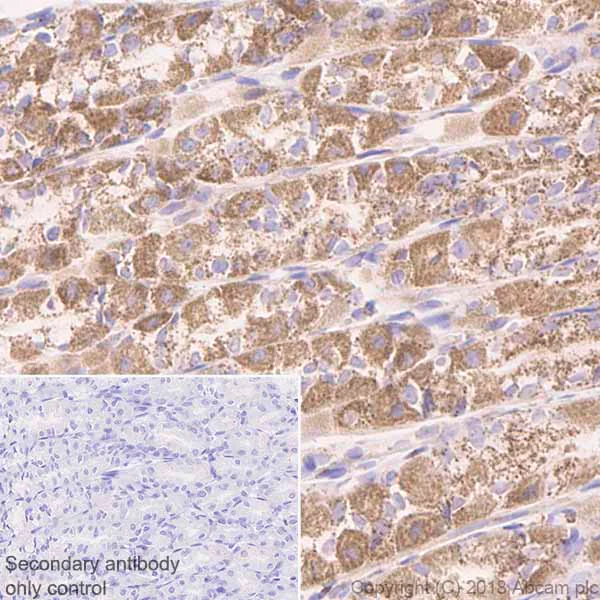 Immunohistochemistry (Formalin/PFA-fixed paraffin-embedded sections) - Anti-CLPP antibody [EPR7133] (AB124822)