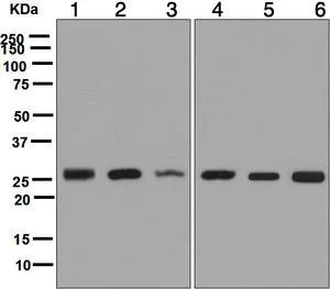 Western blot - Anti-CLPP antibody [EPR7133] (AB124822)