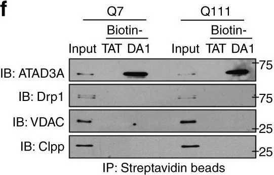 Western blot - Anti-CLPP antibody [EPR7133] (AB124822)