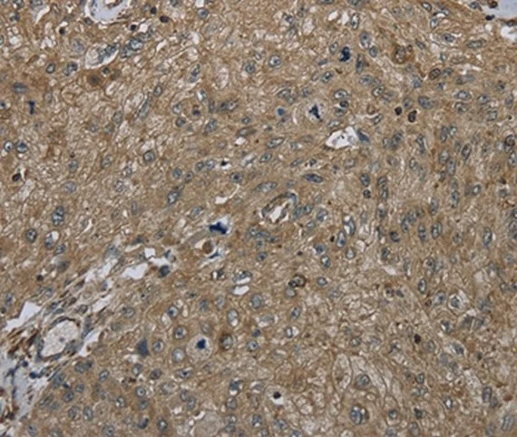 Immunohistochemistry (Formalin/PFA-fixed paraffin-embedded sections) - Anti-CLPS antibody (AB198166)