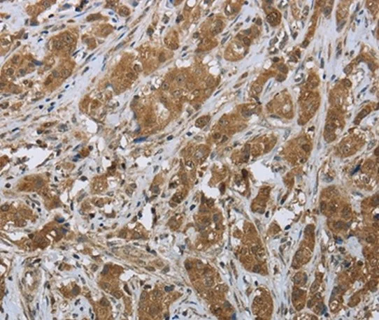 Immunohistochemistry (Formalin/PFA-fixed paraffin-embedded sections) - Anti-CLPS antibody (AB198166)