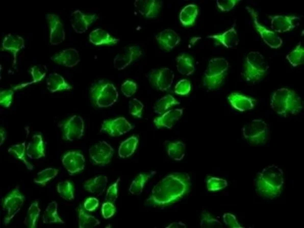 Immunocytochemistry/ Immunofluorescence - Anti-CLPTM1 antibody [EPR8800] (AB133756)