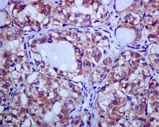 Immunohistochemistry (Formalin/PFA-fixed paraffin-embedded sections) - Anti-CLPTM1 antibody [EPR8800] (AB133756), expandable thumbnail