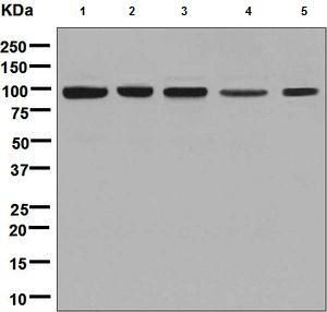 Western blot - Anti-CLPTM1 antibody [EPR8800] (AB133756), expandable thumbnail