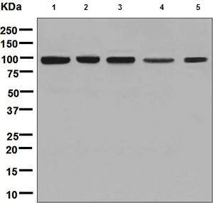 Western blot - Anti-CLPTM1 antibody [EPR8800] (AB133756)