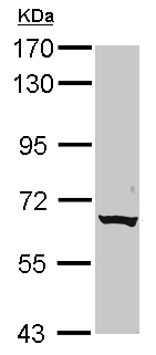 Western blot - Anti-CLPTM1L antibody (AB155119), expandable thumbnail