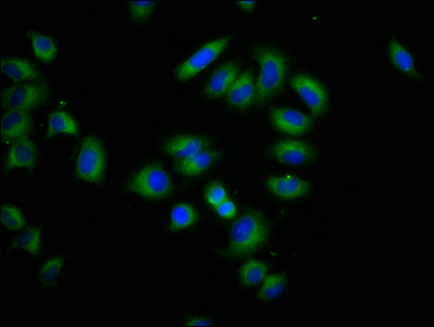 Immunocytochemistry/ Immunofluorescence - Anti-CLPTM1L antibody (AB237620), expandable thumbnail