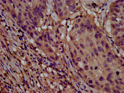 Immunohistochemistry (Formalin/PFA-fixed paraffin-embedded sections) - Anti-CLPTM1L antibody (AB237620), expandable thumbnail