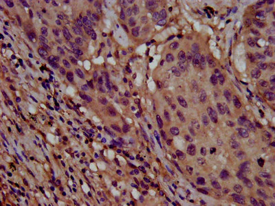 Immunohistochemistry (Formalin/PFA-fixed paraffin-embedded sections) - Anti-CLPTM1L antibody (AB237620)