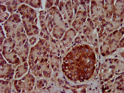 Immunohistochemistry (Formalin/PFA-fixed paraffin-embedded sections) - Anti-CLPTM1L antibody (AB237620)