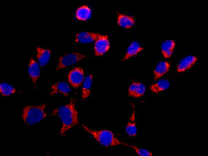 Immunocytochemistry/ Immunofluorescence - Anti-CLPX antibody [EP8772] (AB168338), expandable thumbnail