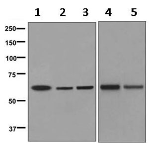 Western blot - Anti-CLPX antibody [EP8772] (AB168338), expandable thumbnail