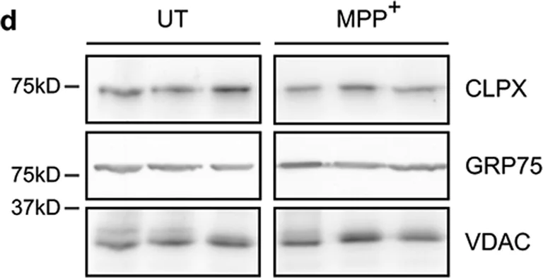 Western blot - Anti-CLPX antibody [EP8772] (AB168338)