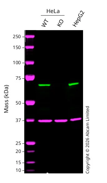 Western blot - Anti-CLPX antibody [EP8772] (AB168338)