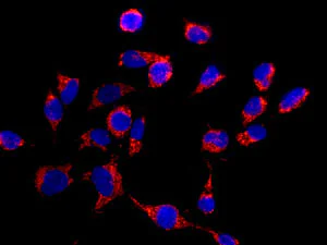 Immunocytochemistry/ Immunofluorescence - Anti-CLPX antibody [EP8772] - BSA and Azide free (AB240151)