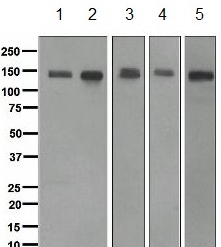 Western blot - Anti-CLSTN1 antibody [EPR2963] (AB134130), expandable thumbnail