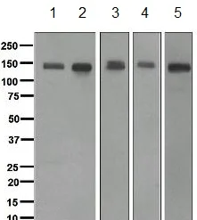 Western blot - Anti-CLSTN1 antibody [EPR2963] (AB134130)