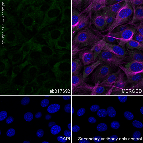 Immunocytochemistry/ Immunofluorescence - Anti-CLUH antibody [EPR28732-85] (ab317693), expandable thumbnail
