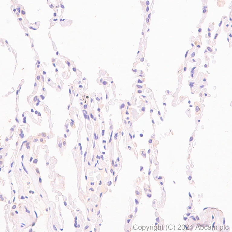 Immunohistochemistry (Formalin/PFA-fixed paraffin-embedded sections) - Anti-CLUH antibody [EPR28732-85] (AB317693)