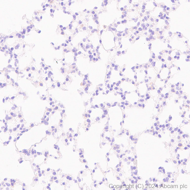 Immunohistochemistry (Formalin/PFA-fixed paraffin-embedded sections) - Anti-CLUH antibody [EPR28732-85] (AB317693)