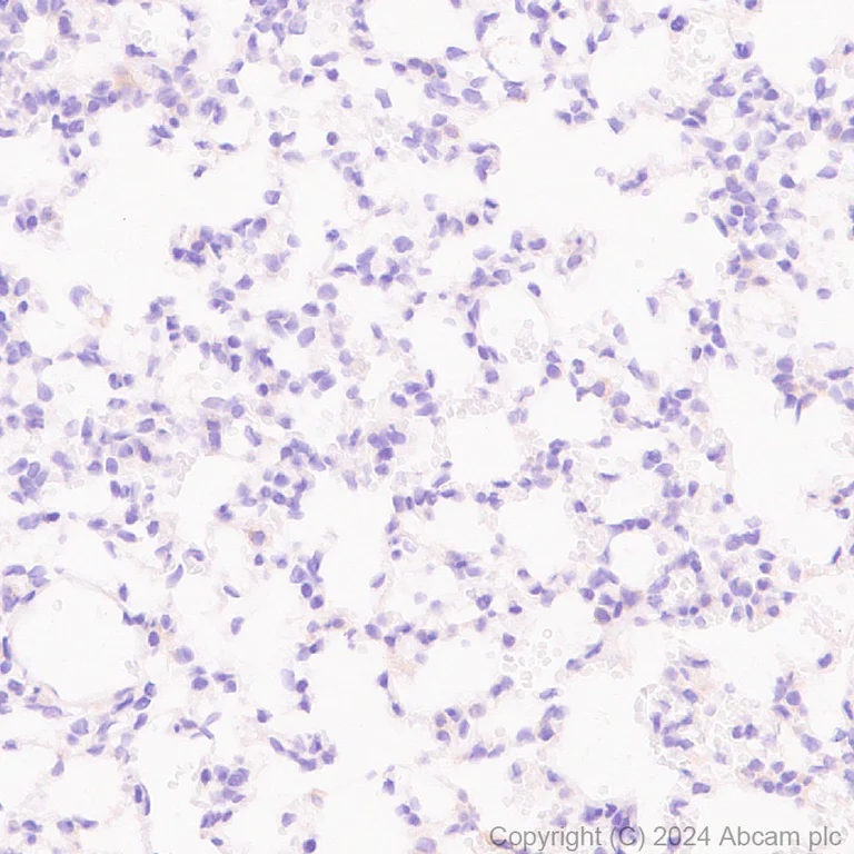 Immunohistochemistry (Formalin/PFA-fixed paraffin-embedded sections) - Anti-CLUH antibody [EPR28732-85] (AB317693)