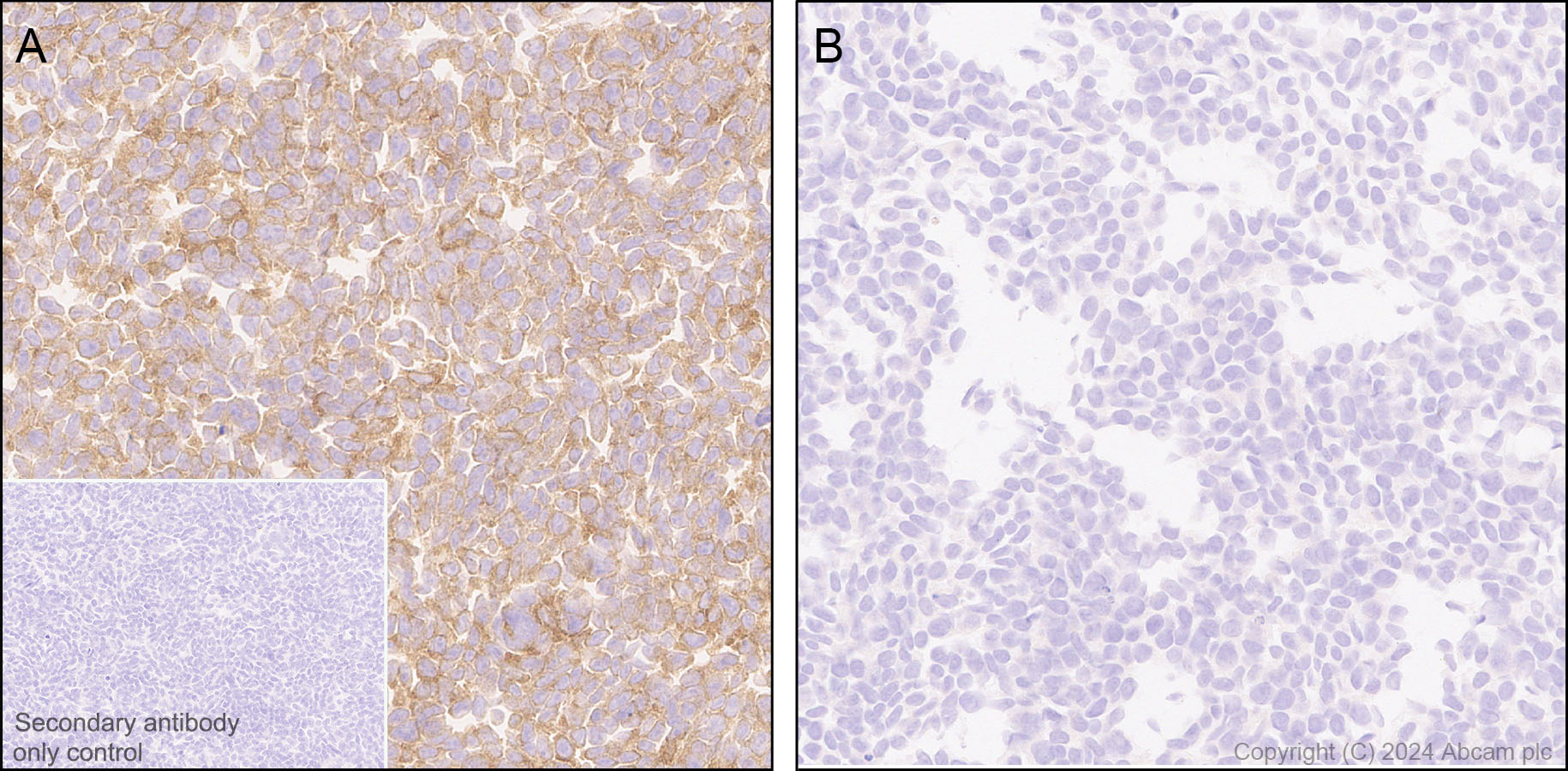 Immunohistochemistry (Formalin/PFA-fixed paraffin-embedded sections) - Anti-CLUH antibody [EPR28732-85] (AB317693), expandable thumbnail