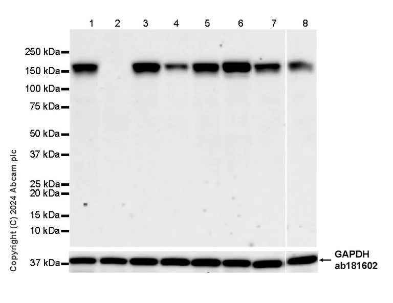 Western blot - Anti-CLUH antibody [EPR28732-85] (AB317693)