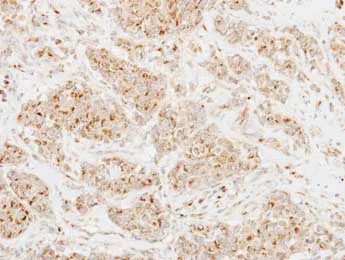 Immunohistochemistry (Formalin/PFA-fixed paraffin-embedded sections) - Anti-CLUL1 antibody (AB153916)
