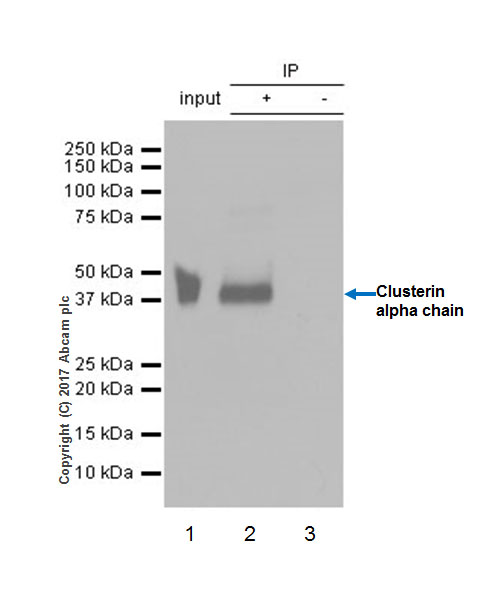 Immunoprecipitation - Anti-Clusterin alpha chain antibody [EPR17539-95] (ab184100), expandable thumbnail