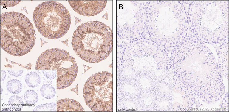 Immunohistochemistry (Formalin/PFA-fixed paraffin-embedded sections) - Anti-Clusterin alpha chain antibody [EPR17539-95] - BSA and Azide free (AB230150)