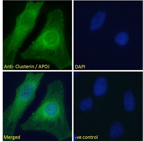 Immunocytochemistry/ Immunofluorescence - Anti-Clusterin antibody (AB39991)