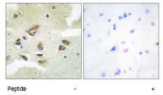 Immunohistochemistry (Formalin/PFA-fixed paraffin-embedded sections) - Anti-Clusterin antibody (AB69644)