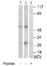 Western blot - Anti-Clusterin antibody (AB69644)