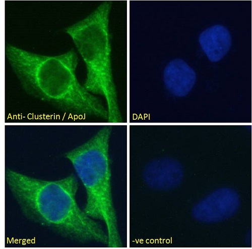 Immunocytochemistry/ Immunofluorescence - Anti-Clusterin antibody (AB79280), expandable thumbnail