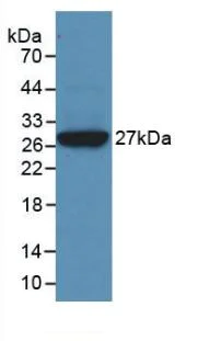 Western blot - Anti-Clusterin antibody [C2] (AB239486)