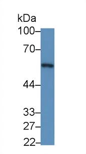 Western blot - Anti-Clusterin antibody [C2] (AB239486)