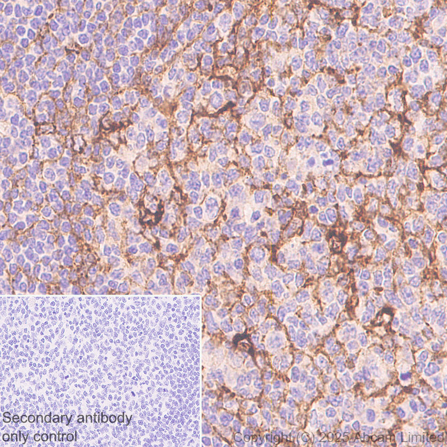 Immunohistochemistry (Formalin/PFA-fixed paraffin-embedded sections) - Anti-Clusterin antibody [RM1292] (ab323182), expandable thumbnail