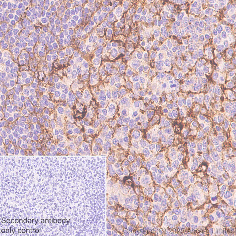 Immunohistochemistry (Formalin/PFA-fixed paraffin-embedded sections) - Anti-Clusterin antibody [RM1292] (AB323182)