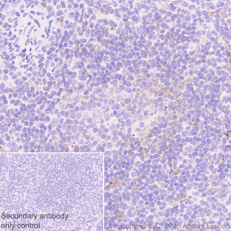 Immunohistochemistry (Formalin/PFA-fixed paraffin-embedded sections) - Anti-Clusterin antibody [RM1292] (ab323182), expandable thumbnail